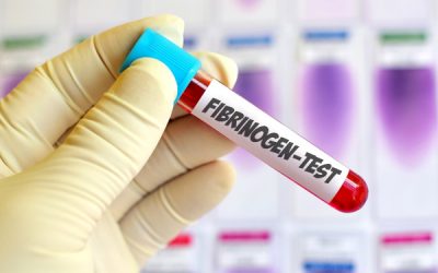 Fenotipo e terapia difetti del fibrinogeno