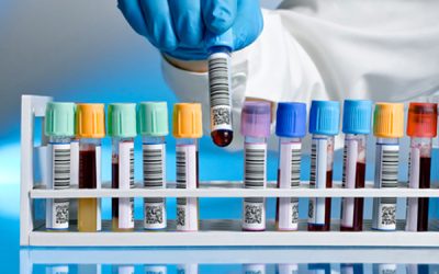 Laboratorio e gestione della terapia dell’emofilia