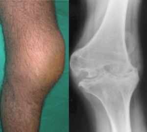 Esame_radiografico