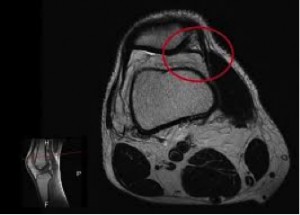 Risonanza_magnetica