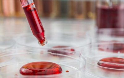 L’inchiesta sul sangue infetto nel Regno Unito